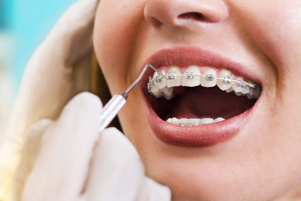 orthodontist in garvey 