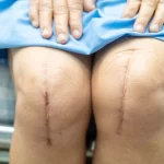 Specialized care in orthopedics treatments: Supporting a pain-free life
